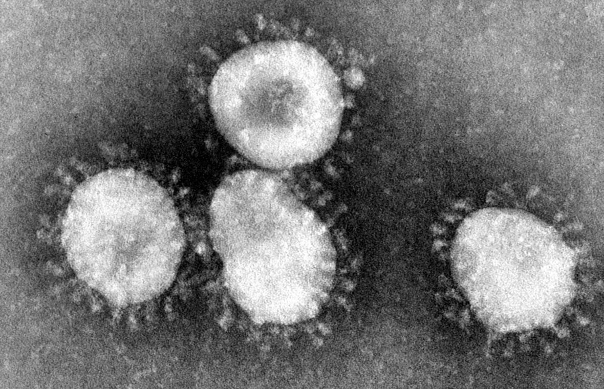 Coronavirus visto desde microscopio