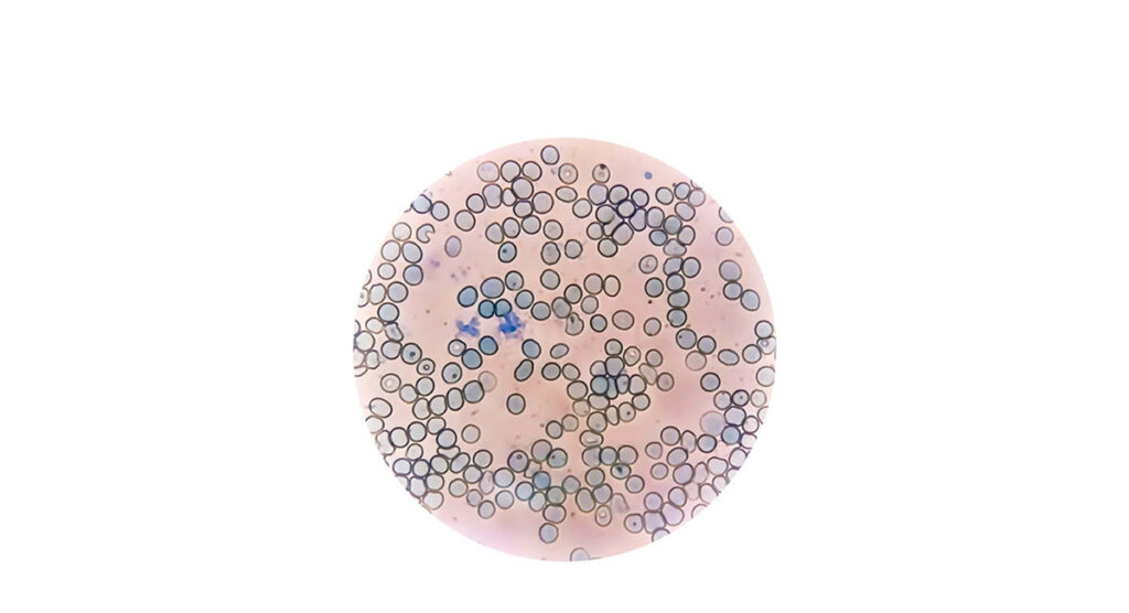 Azul de Metileno en Microscopia - Usos - Lensforvision